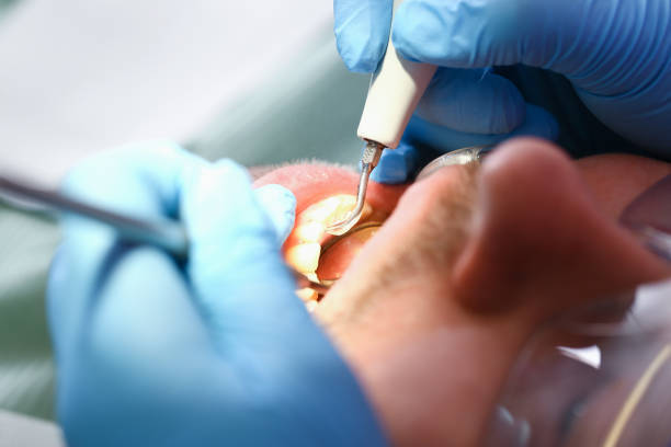 Best Pediatric Emergency Dentist in Martins Ferry, OH